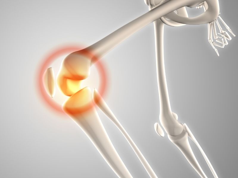 kemik-kisti-tedavisinde-tekrarlama-riski
