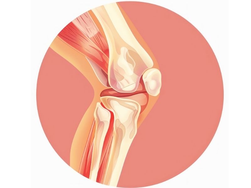 on-capraz-bag-ameliyati-kac-saat-surer