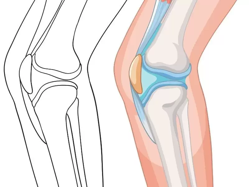 arka-capraz-bag-kopmasi