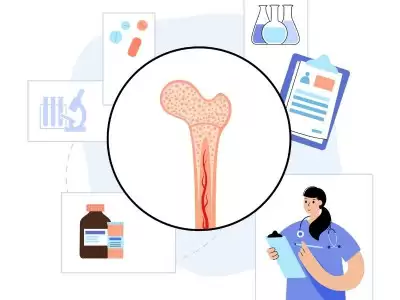 iyi-huylu-kemik-tumoru