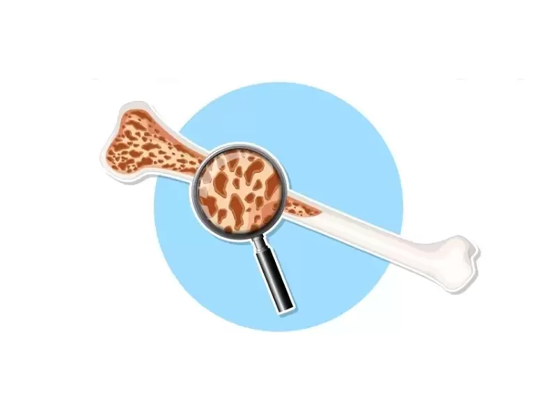 kemik-metastazi-hakkinda-merak-edilenler