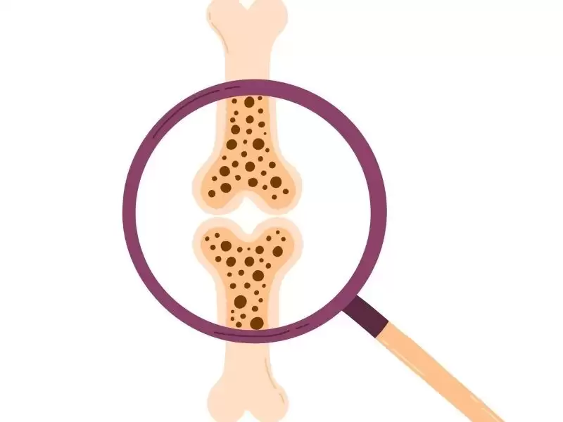 kemik-metastazi-nedir