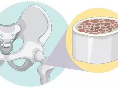 kemik-ve-yumusak-doku-tumorleri