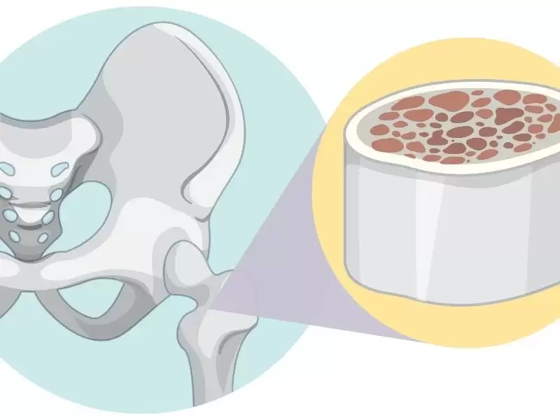 kemik-ve-yumusak-doku-tumorleri