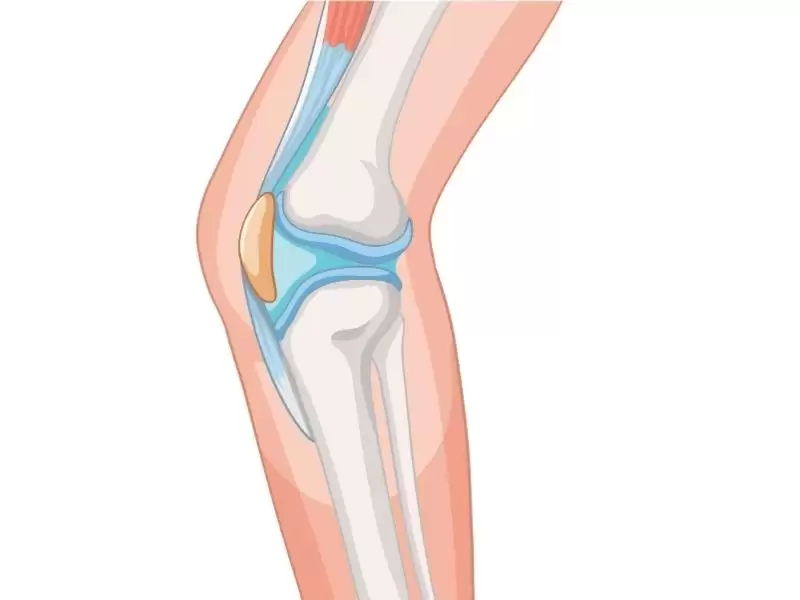 on-capraz-bag-cerrahisi-sonrasi-spora-donus