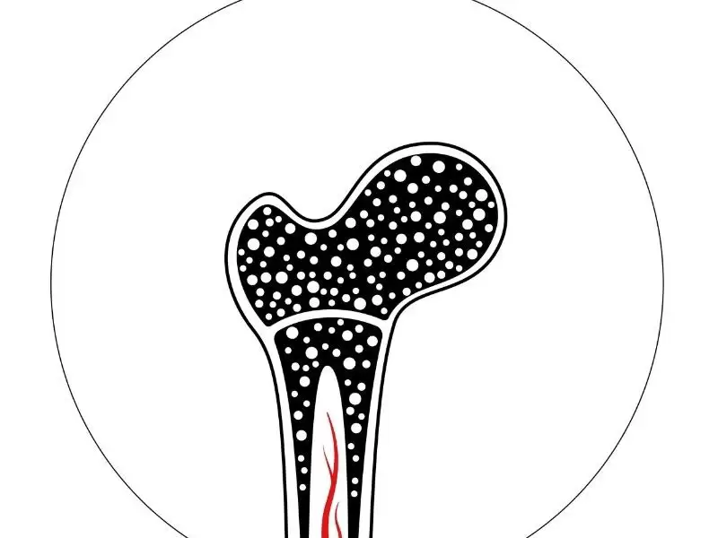 osteosarkom-kemik-kanseri