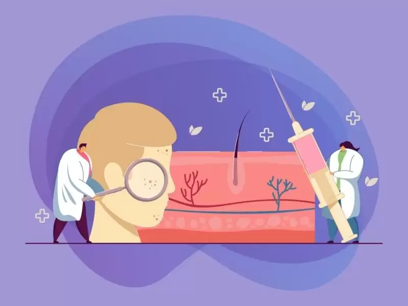 prp-tedavisi-nedir-prp-tedavisi-nasil-uygulanir