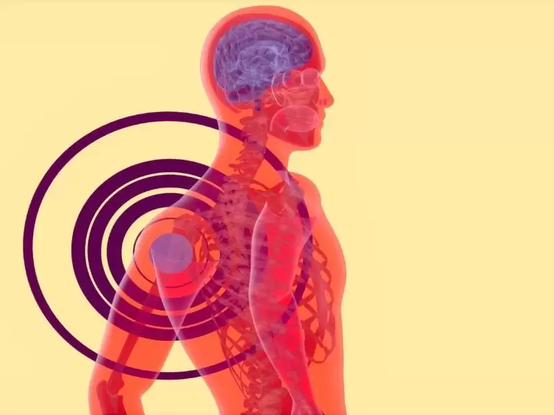 sinir-sikismasi-nedir-sinir-sikismasi-tedavileri-nelerdir