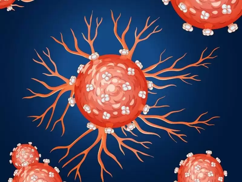 yumusak-doku-kanseri-sarkom