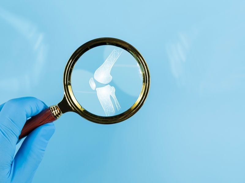 iyi-huylu-kemik-tumoru-nedir