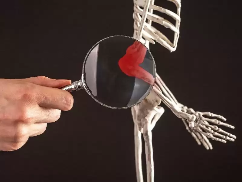 ewing-sarkomu-belirtileri-ve-tedavisi-nedir