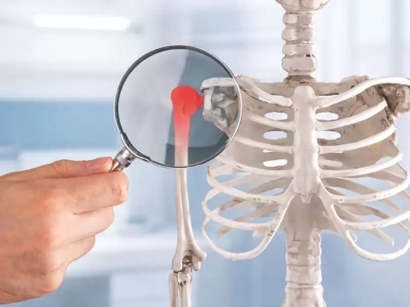 kemik-metastazi-nedir