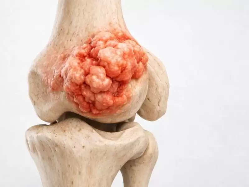 kemik-tumorleri-nelerdir-kemik-tumoru-tani-ve-tedavileri-nelerdir