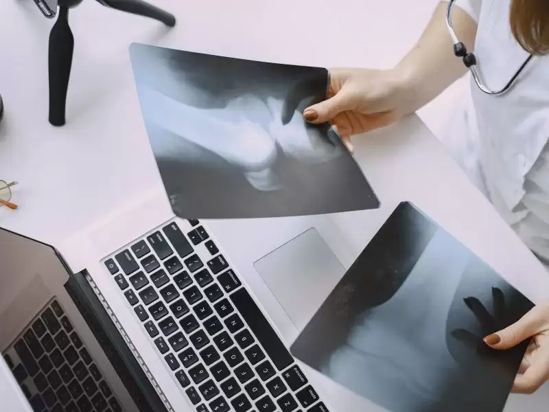 kemik-tumoru-tedavisi